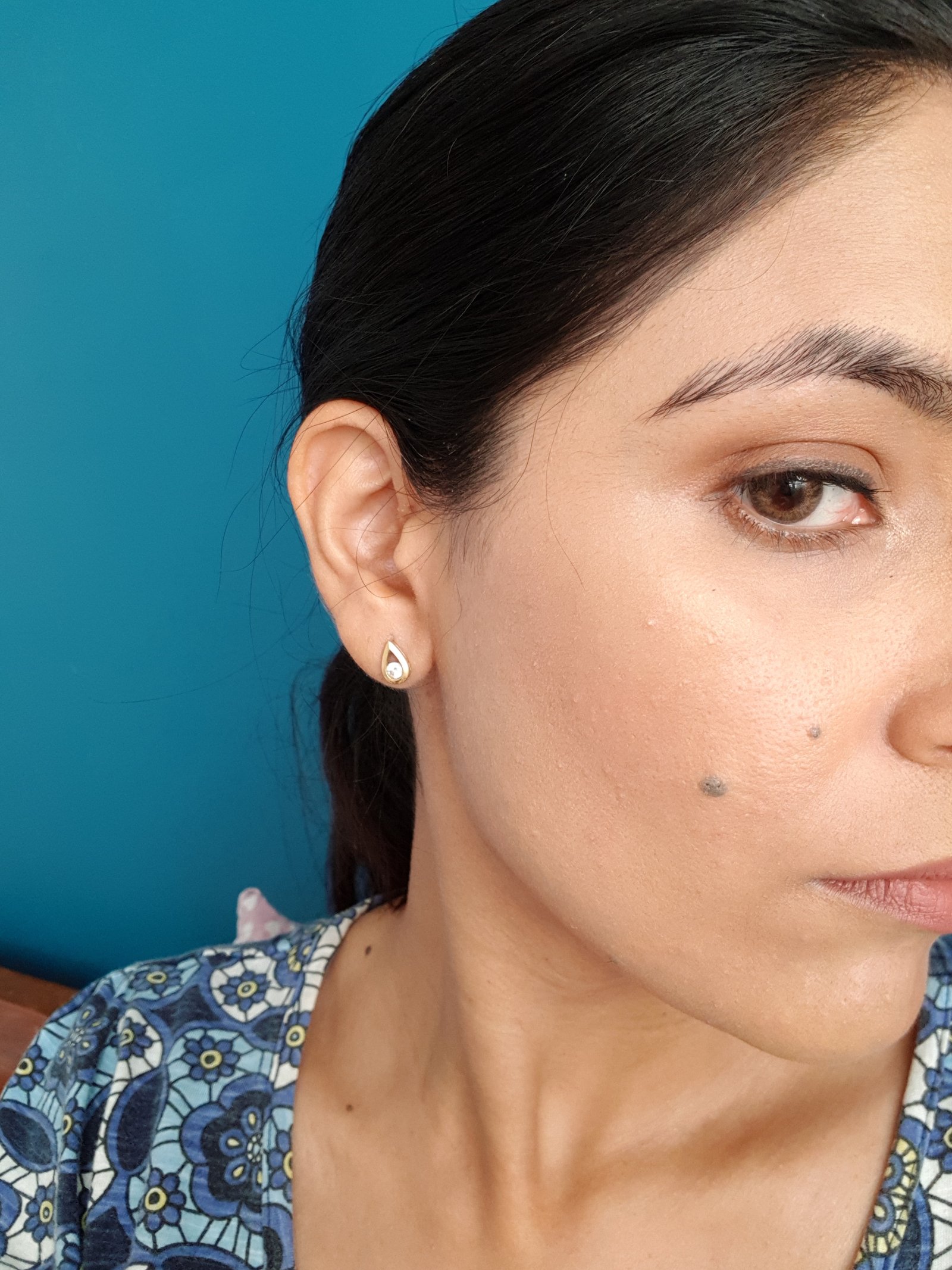 Laura Geller Filter First Concealer on this side. Redness and most imperfections covered.